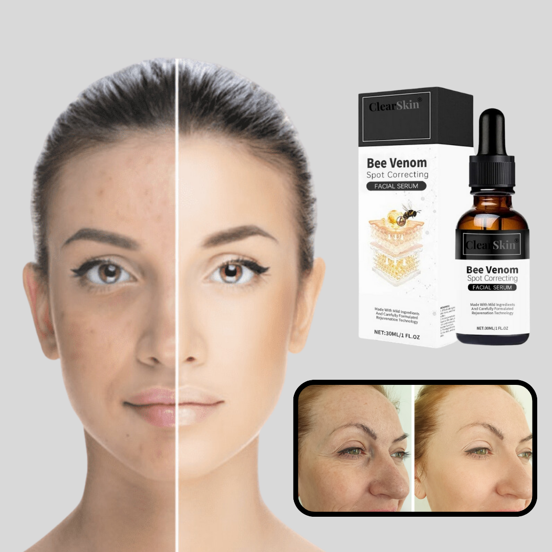 ClearSkin® Serum