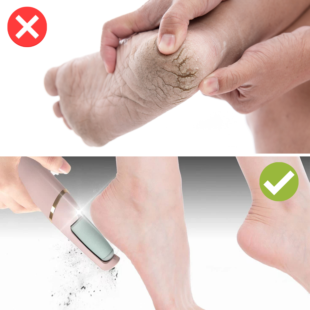 EzNails™ Elektrische Pediküre Maschine