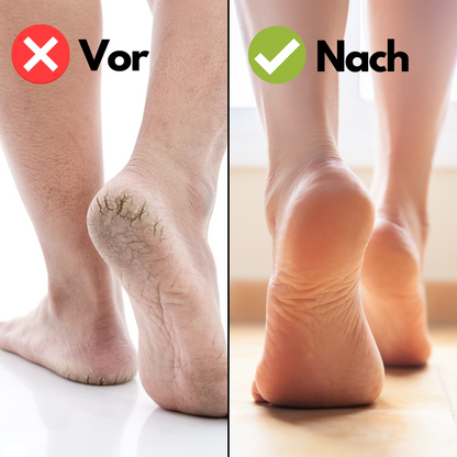 EzNails™ Elektrische Pediküre Maschine